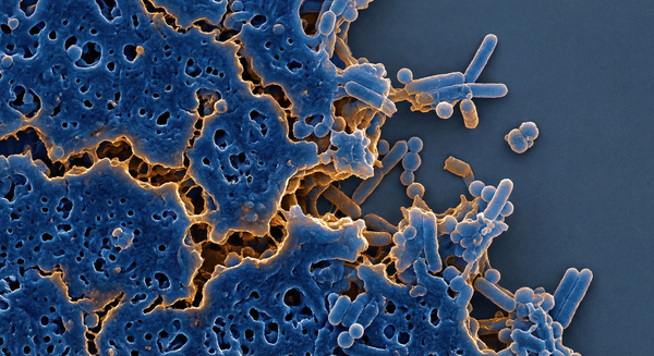 Why We're Hunting for Antibiotic Combinations That Already Exist